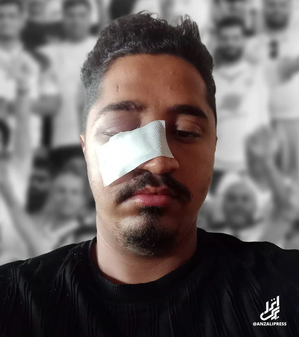هوادار ملوان نابینا شد